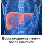 Історія інсульту і боротьби з ним