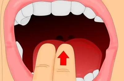 Як швидко викликати блювоту в домашніх умовах все способи (домашніх) Як швидко викликати блювоту в домашніх умовах все способи