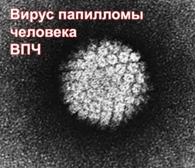 Яка найефективніша мазь від папілом на обличчі, шиї, інтимних місцях оксолінова, віферон, (яка) Яка найефективніша мазь від папілом на обличчі, шиї, інтимних місцях оксолінова, віферон,