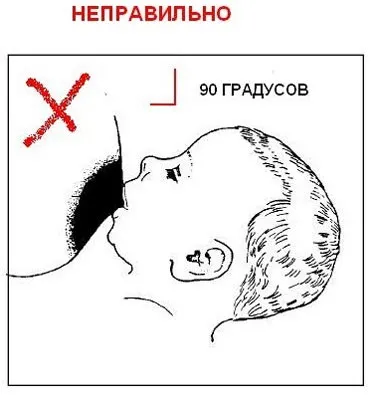 Як годувати дитину без болю тріщини і садна на грудях (як вилікувати тріщини сосків) Як годувати дитину без болю тріщини і садна на грудях