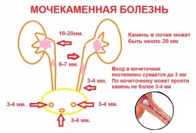 Печіння і свербіж в сечівнику у чоловіків без виділень після семяіспусканія