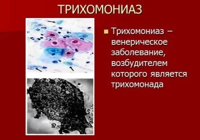 Печіння і свербіж в сечівнику у чоловіків без виділень після семяіспусканія