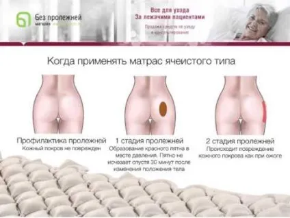 Як вибрати протипролежневі матрац і який краще для використання (який) Як вибрати протипролежневі матрац і який краще для використання