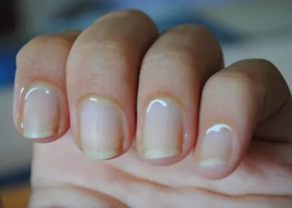 Як я роблю манікюр з гелем для видалення кутикули sally hansen gel cuticle remover відгуки (кутикули) Як я роблю манікюр з гелем для видалення кутикули sally hansen gel cuticle remover відгуки
