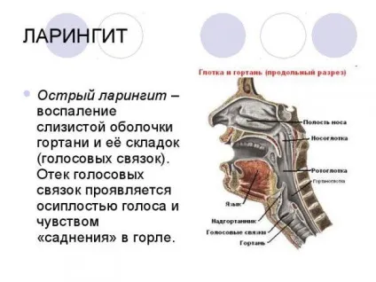 Як відновити голос після застуди пропав, осип, повернути, як лікувати (відновити) Як відновити голос після застуди пропав, осип, повернути, як лікувати