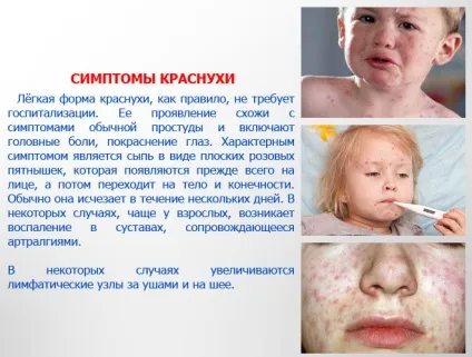 Краснуха - фото з особливостями проявів хвороби (фото) Краснуха - фото з особливостями проявів хвороби