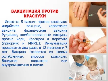 Краснуха - фото з особливостями проявів хвороби (краснуха) Краснуха - фото з особливостями проявів хвороби