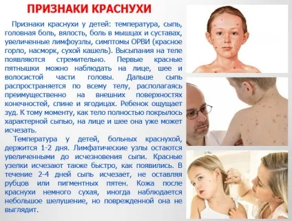 Краснуха - фото з особливостями проявів хвороби (краснуха) Краснуха - фото з особливостями проявів хвороби