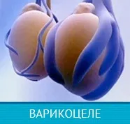 Кровотеча після операції з видалення геморою (після хірургічного втручання) Кровотеча після операції з видалення геморою