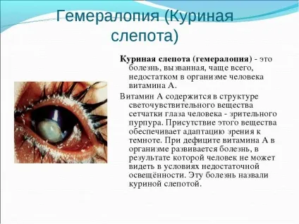 Куряча сліпота - причини, симптоми і лікування хвороби (куряча) Куряча сліпота - причини, симптоми і лікування хвороби