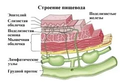 Лейкоплакія стравоходу і її лікування (перший по стравоходу) Лейкоплакія стравоходу і її лікування
