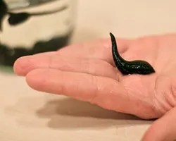 Лікування варикозу п'явками в домашніх умовах (п'явками) Лікування варикозу п'явками в домашніх умовах