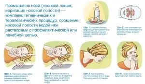 Лікування поліпів в носі без операції методи, засоби