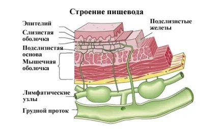 Лейкоплакія стравоходу лікування, дієта (хворому лейкоплакией стравоходу) Лейкоплакія стравоходу лікування, дієта