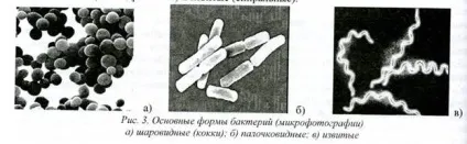 Морфологія і ультраструктура бактеріальної клітини - студопедія (реферат) Морфологія і ультраструктура бактеріальної клітини - студопедія