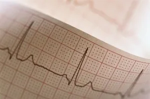 Наскільки ефективно лікування дистрофічних змін міокарда (лікування) Наскільки ефективно лікування дистрофічних змін міокарда