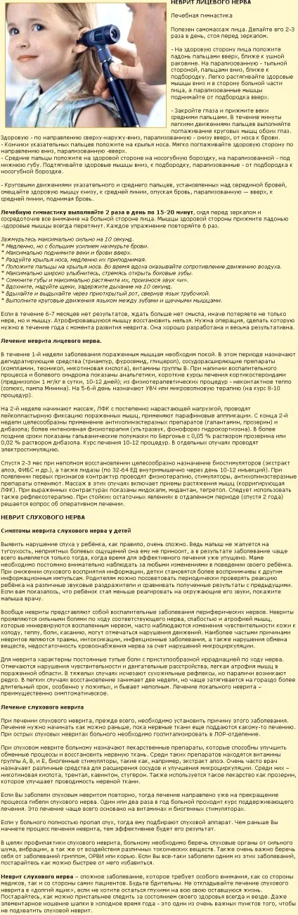 Неврит лицьового нерва, лікування невриту у дитини, симптоми слухового невриту (лицьовій неврит лікування) Неврит лицьового нерва, лікування невриту у дитини, симптоми слухового невриту