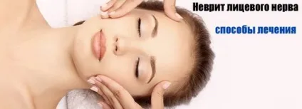 Неврит лицьового нерва