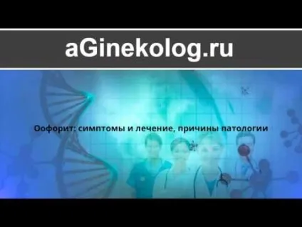 Оофорит (хронічний, двосторонній) що це таке, симптоми і лікування препаратами (симптоми) Оофорит (хронічний, двосторонній) що це таке, симптоми і лікування препаратами