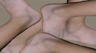 опухли ноги