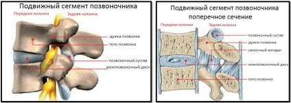Остеохондроз і бодібілдинг