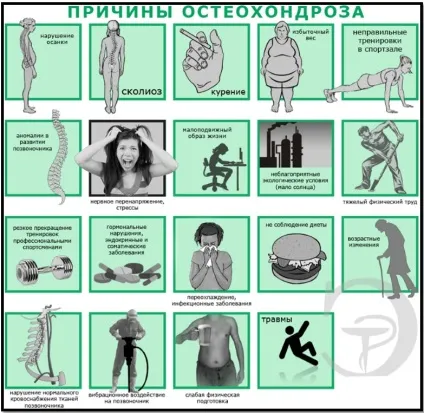 Остеохондроз і бодібілдинг