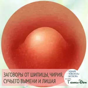 Pаговори від шіпіци і чірія (шіпіци) Pаговори від шіпіци і чірія