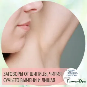 Pаговори від шіпіци і чірія (шіпіци) Pаговори від шіпіци і чірія