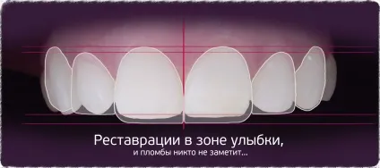 передні зуби