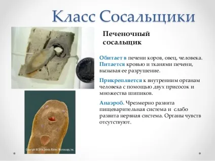 печінковий сисун