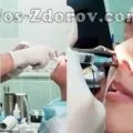 Підслизова вазотомія нижніх носових раковин види, фото, відео, відгуки (нижніх) Підслизова вазотомія нижніх носових раковин види, фото, відео, відгуки