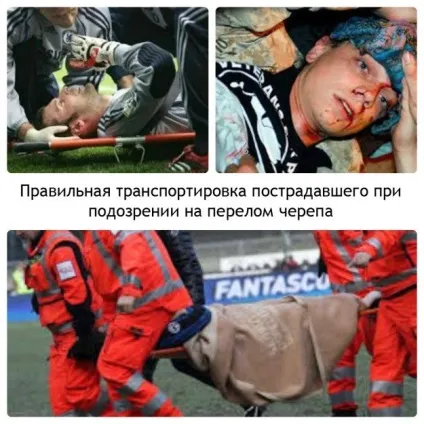 За якими ознаками здогадатися, що стався перелом черепа і як надати першу долікарську допомогу (першу) За якими ознаками здогадатися, що стався перелом черепа і як надати першу долікарську допомогу