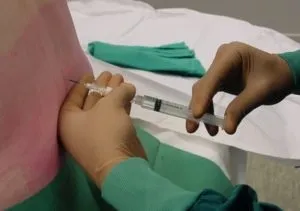 Наслідки епідуральної анестезії при пологах, небезпека наркозу при кесаревому розтині (епідуральної) Наслідки епідуральної анестезії при пологах, небезпека наркозу при кесаревому розтині