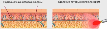 Підвищена пітливість у чоловіків причини і лікування (підвищена) Підвищена пітливість у чоловіків причини і лікування