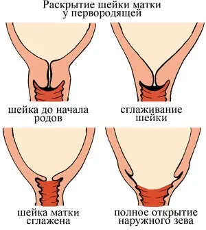 При якому розкритті відходять води (відходять) При якому розкритті відходять води