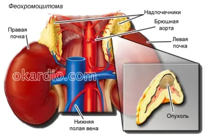 Причини крові з носа у дорослих і дітей, разове і регулярне (дорослих) Причини крові з носа у дорослих і дітей, разове і регулярне