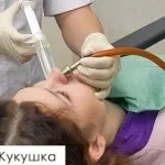 Промивання носа зозулею процедура при гаймориті (гаймориті) Промивання носа зозулею процедура при гаймориті