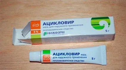 Застуда на губах - швидке лікування в домашніх умовах народними засобами (застуда) Застуда на губах - швидке лікування в домашніх умовах народними засобами