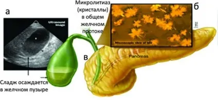сладж синдром