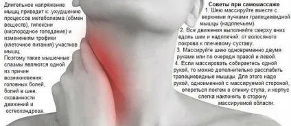 Спазм м'язів шиї причини, як зняти спазми і лікування (спазми м'язи шиї ознаки симптоми діагностика лікування фізіотерапевтичні процедури профілактика) Спазм м'язів шиї причини, як зняти спазми і лікування