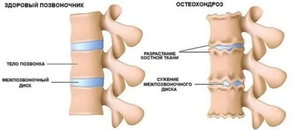 Спазм м'язів шиї причини, як зняти спазми і лікування (спазм) Спазм м'язів шиї причини, як зняти спазми і лікування