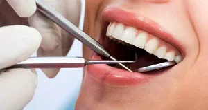 Стоматологія Мар'їно на братиславській в москві «ідеал-с» (стоматологічна клініка) Стоматологія Мар'їно на братиславській в москві «ідеал-с»