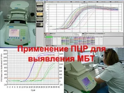 Туберкульоз МЛС множинна лікарська стійкість, симптоми і лікування (лікарська) Туберкульоз МЛС множинна лікарська стійкість, симптоми і лікування