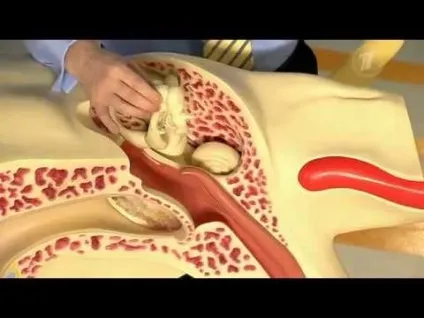 Вушної свищ лікування у дитини і дорослого (лікування) Вушної свищ лікування у дитини і дорослого