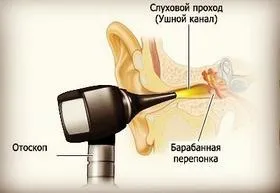 Погіршення слуху - причини і лікування зниження слуху (лікування) Погіршення слуху - причини і лікування зниження слуху