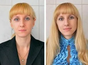 Збільшення губ гіалуронової кислотою відгуки та фото до процедури і після, ціна гіалуронка, поради (збільшення губа гіалуронової кислоти фото після відгук накачувати ціна гіалуронова гіалуронка збільшувати) Збільшення губ гіалуронової кислотою відгуки та фото до процедури і після, ціна гіалуронка, поради
