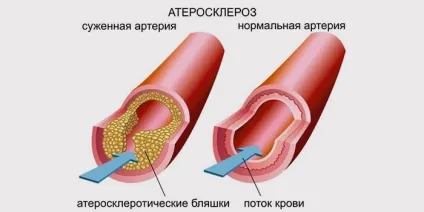 Узі черевної аорти та її гілок підготовка, проведення та розшифровка (процедура) Узі черевної аорти та її гілок підготовка, проведення та розшифровка