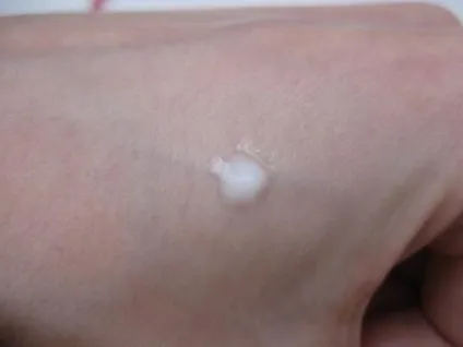 Догляд clinique з серії anti blemish solutions докладно і по поличках відгуки (anti) Догляд clinique з серії anti blemish solutions докладно і по поличках відгуки