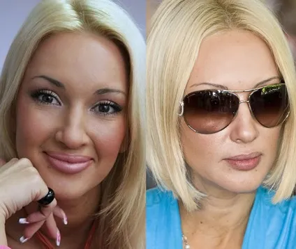 Вічна молодість Лєри Кудрявцевої (лера кудрявцева пластична хірурги) Вічна молодість Лєри Кудрявцевої
