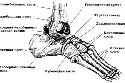 Лікування перелому стопи ноги (перелом) Лікування перелому стопи ноги